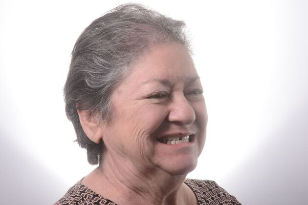 Our Results: ALL ON 4 CASE WHIT SAME DAY TEETH INTERIM ARCHES - Before