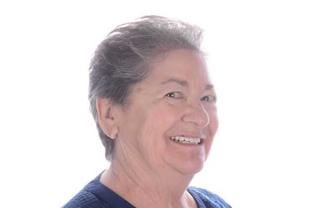 Our Results: ALL ON 4 CASE WHIT SAME DAY TEETH INTERIM ARCHES - After