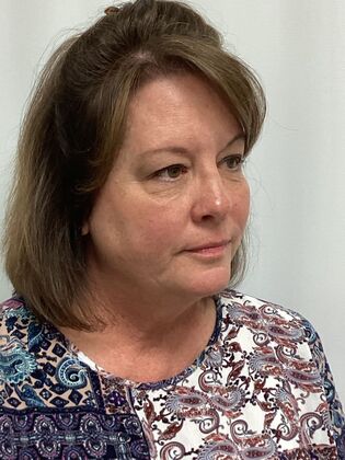 Facial Eyelid Surgery / Blepharoplasty: Case 14 (5086182) - Before