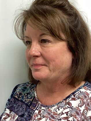 Facial Eyelid Surgery / Blepharoplasty: Case 14 (5086182) - Before