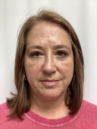 Facial Eyelid Surgery / Blepharoplasty Case 15 (3271890) - After