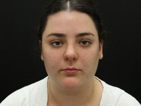 Face & Neck Lifts: Case 42 - Before