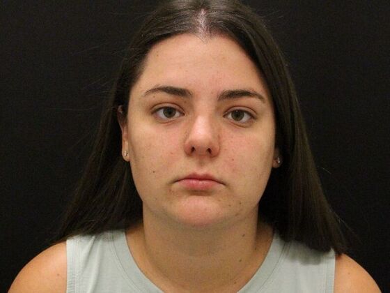 Face & Neck Lifts: Case 42 - After