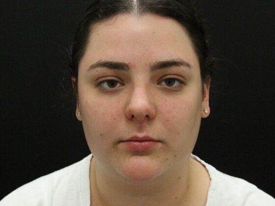 Liposuction: Case 30 - Before