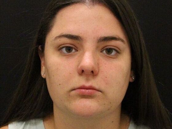 Liposuction: Case 30 - After