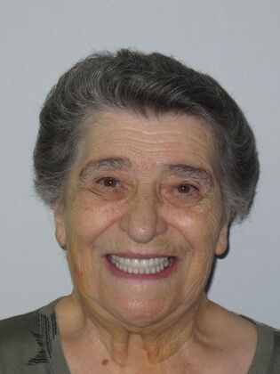 Teeth in a Day: Wow, another dramatic transformation - After