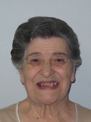 Teeth in a Day: Wow, another dramatic transformation - Before