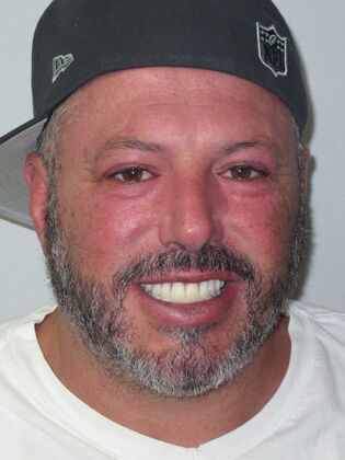 Teeth in a Day: Embarrassment in rearview mirror - After