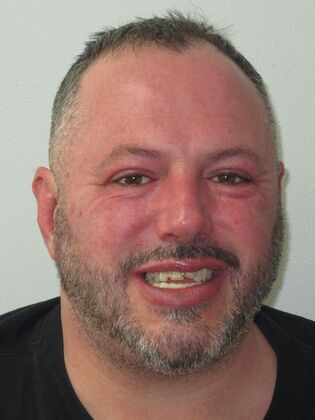 Teeth in a Day: Embarrassment in rearview mirror - Before