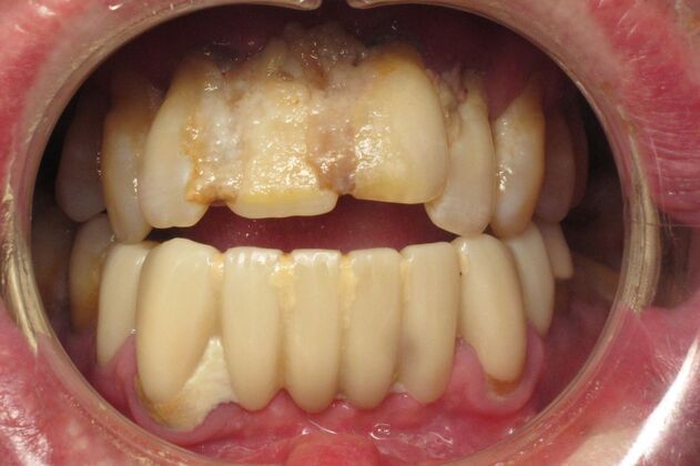 Teeth in a Day: Embarrassment in rearview mirror - Before
