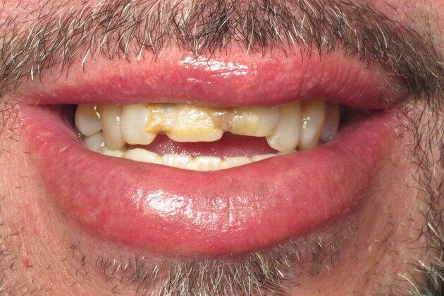 Teeth in a Day: Embarrassment in rearview mirror - Before