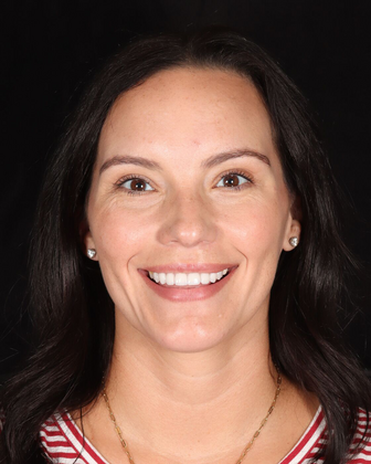 Smile Makeover Cases