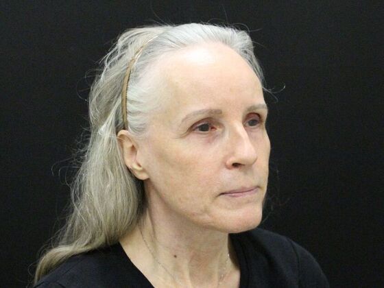 Face & Neck Lifts Case 3 - After