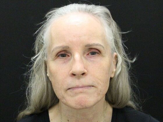 Face & Neck Lifts: Case 3 - After