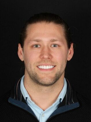 Porcelain Veneers Zac - After