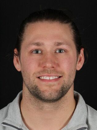 Porcelain Veneers Zac - Before