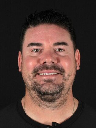 Porcelain Veneers: Tony - Before