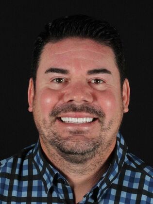 Porcelain Veneers: Tony - After