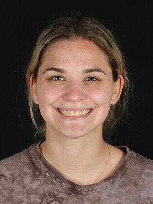 Porcelain Veneers Madison - Before