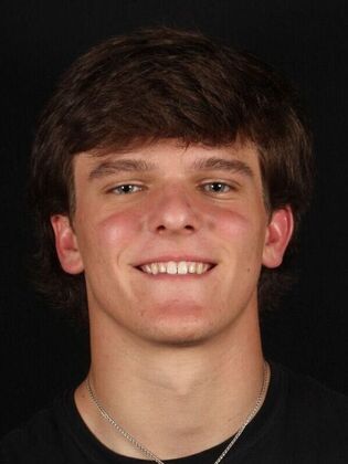 Porcelain Veneers Luke - Before