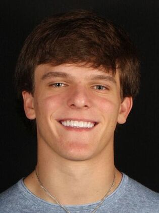 Porcelain Veneers Luke - After