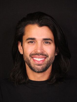 Full Mouth Rehabilitation Eric - Before