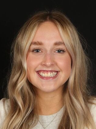 Dental Implants Zoe - Before