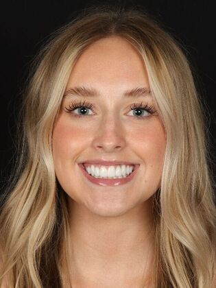 Dental Implants Zoe - After