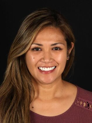 Dental Implants Cathy - After