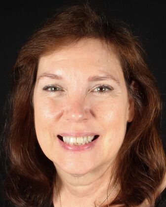 Dental Implants Paula - Before