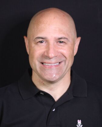 Full Mouth Rehabilitation Mark - Before