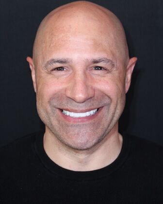 Full Mouth Rehabilitation Mark - After