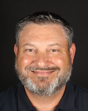 Full Mouth Rehabilitation John - Before