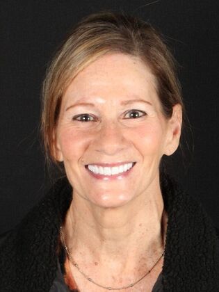 Full Mouth Rehabilitation Carol - After