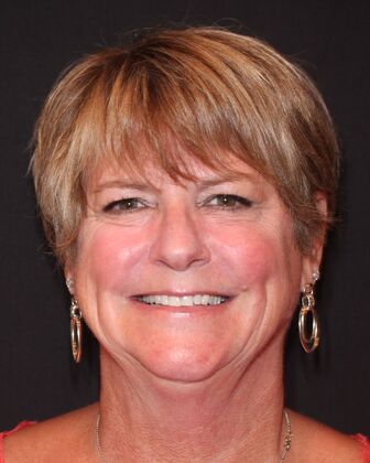 Porcelain Veneers Michelle. - Before