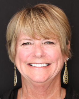 Porcelain Veneers Michelle. - After