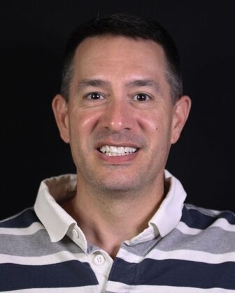 Porcelain Veneers Greg - Before