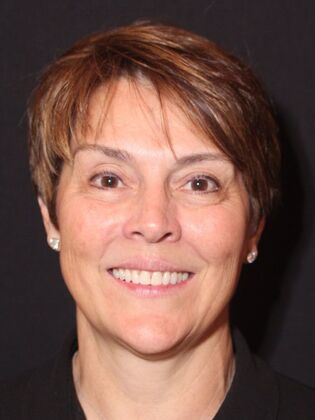 Porcelain Veneers Julia - Before