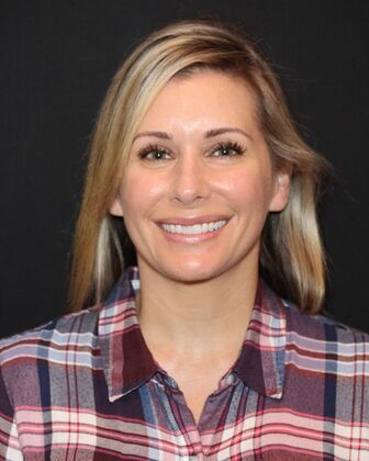 Porcelain Veneers Alison - Before