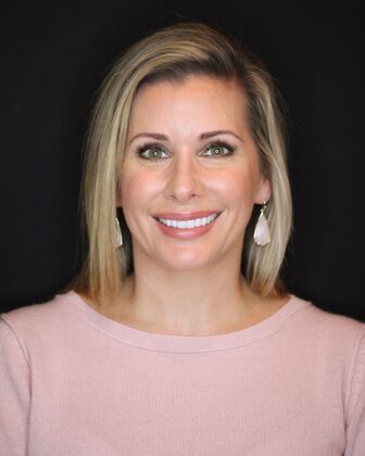 Porcelain Veneers Alison - After