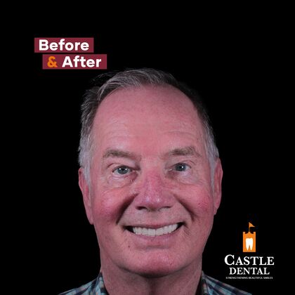 Removable Dentures Case