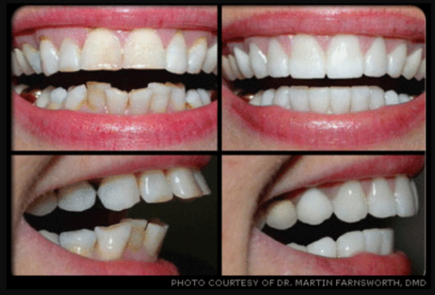 Cosmetic Dentistry Cases