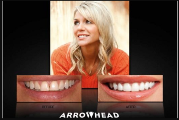 Cosmetic Dentistry Case 2