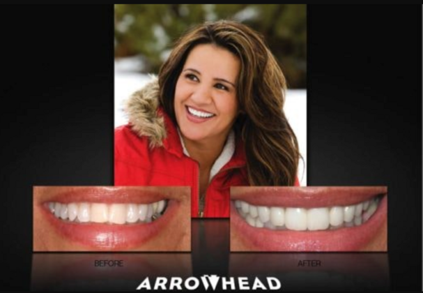 Cosmetic Dentistry Case 3