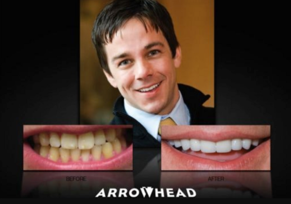 Cosmetic Dentistry Case 4