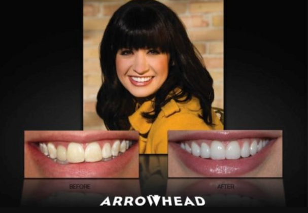 Cosmetic Dentistry Case 5