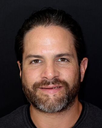 Full Mouth Rehabilitation Andrew - Before