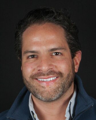 Full Mouth Rehabilitation Andrew - After