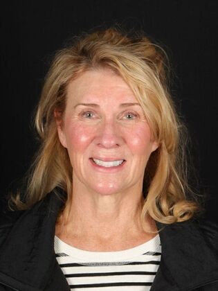 Dental Implants Sheri - Before