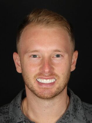 Porcelain Veneers Blaine - After